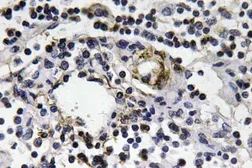 Anti-Interferon gamma antibody used in IHC (Paraffin sections) (IHC-P). GTX66714