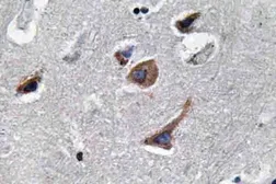 Anti-IL12A / IL12 p35 antibody used in IHC (Paraffin sections) (IHC-P). GTX66715