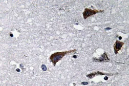 Anti-Cathepsin B antibody used in IHC (Paraffin sections) (IHC-P). GTX66719