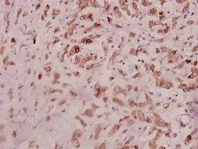 Anti-IL11 antibody used in IHC (Paraffin sections) (IHC-P). GTX66720