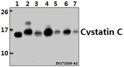 Anti-Cystatin C antibody used in Western Blot (WB). GTX66728