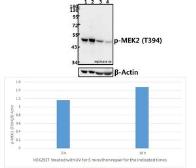 Anti-MEK2 (phospho Thr394) antibody used in Western Blot (WB). GTX66729
