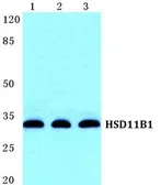 Anti-HSD11B1 antibody used in Western Blot (WB). GTX66731