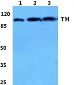 Anti-Thrombomodulin antibody used in Western Blot (WB). GTX66734