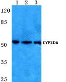 Anti-Cytochrome P450 2D6 antibody used in Western Blot (WB). GTX66735