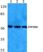 Anti-Cytochrome P450 2D6 antibody used in Western Blot (WB). GTX66735