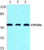 Anti-Cytochrome P450 2D6 antibody used in Western Blot (WB). GTX66736