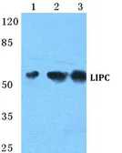 Anti-Hepatic lipase antibody used in Western Blot (WB). GTX66740