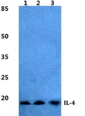 Anti-IL4 antibody used in Western Blot (WB). GTX66741