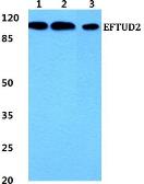 Anti-EFTUD2 antibody used in Western Blot (WB). GTX66744