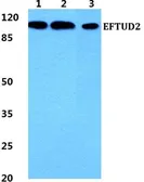 Anti-EFTUD2 antibody used in Western Blot (WB). GTX66744