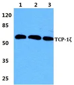 Anti-TCP1 zeta antibody used in Western Blot (WB). GTX66745