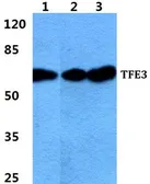 Anti-TFE3 antibody used in Western Blot (WB). GTX66746
