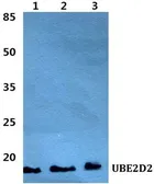 Anti-UBE2D2 antibody used in Western Blot (WB). GTX66747