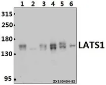 Anti-LATS1 antibody used in Western Blot (WB). GTX66748
