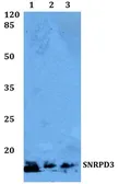 Anti-SNRPD3 antibody used in Western Blot (WB). GTX66749