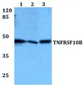 Anti-DR5 antibody used in Western Blot (WB). GTX66750