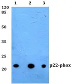 Anti-p22phox antibody used in Western Blot (WB). GTX66756