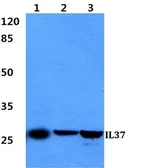 Anti-IL1F7 antibody used in Western Blot (WB). GTX66757