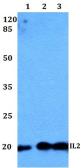 Anti-IL2 antibody used in Western Blot (WB). GTX66758