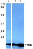 Anti-Defensin beta 1 antibody used in Western Blot (WB). GTX66761