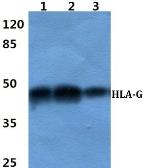 Anti-HLA-G antibody used in Western Blot (WB). GTX66762