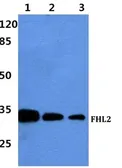 Anti-FHL2 antibody used in Western Blot (WB). GTX66765