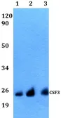 Anti-G-CSF antibody used in Western Blot (WB). GTX66773