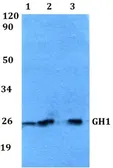 Anti-Growth Hormone antibody used in Western Blot (WB). GTX66777
