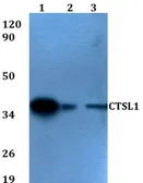 Anti-Cathepsin L antibody used in Western Blot (WB). GTX66781