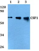 Anti-M-CSF antibody used in Western Blot (WB). GTX66785