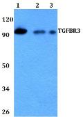 Anti-TGF beta Receptor III antibody used in Western Blot (WB). GTX66788