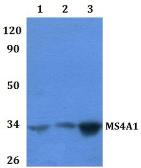 Anti-CD20 antibody used in Western Blot (WB). GTX66791