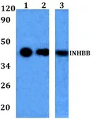 Anti-Inhibin beta B antibody used in Western Blot (WB). GTX66793