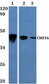Anti-CHST6 antibody used in Western Blot (WB). GTX66796