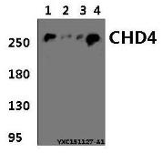 Anti-CHD4 antibody used in Western Blot (WB). GTX66800