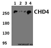 Anti-CHD4 antibody used in Western Blot (WB). GTX66800