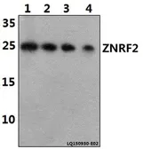 Anti-ZNRF2 antibody used in Western Blot (WB). GTX66801