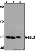 Anti-VGLL2 antibody used in Western Blot (WB). GTX66803