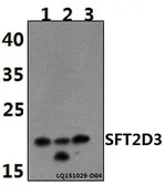 Anti-SFT2D3 antibody used in Western Blot (WB). GTX66804