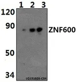 Anti-ZNF600 antibody used in Western Blot (WB). GTX66805