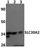 Anti-SLC30A2 antibody used in Western Blot (WB). GTX66806