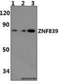 Anti-ZNF839 antibody used in Western Blot (WB). GTX66807