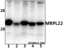 Anti-MRPL22 antibody used in Western Blot (WB). GTX66814