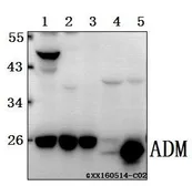 Anti-Adrenomedullin antibody used in Western Blot (WB). GTX66817