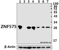 Anti-ZNF575 antibody used in Western Blot (WB). GTX66823