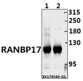 Anti-RanBP17 antibody used in Western Blot (WB). GTX66825