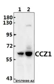 Anti-CCZ1 + CCZ1B antibody used in Western Blot (WB). GTX66826
