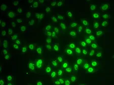 Anti-SNRPD1 antibody used in Immunocytochemistry/ Immunofluorescence (ICC/IF). GTX66830