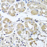 Anti-IL29 antibody used in IHC (Paraffin sections) (IHC-P). GTX66831
